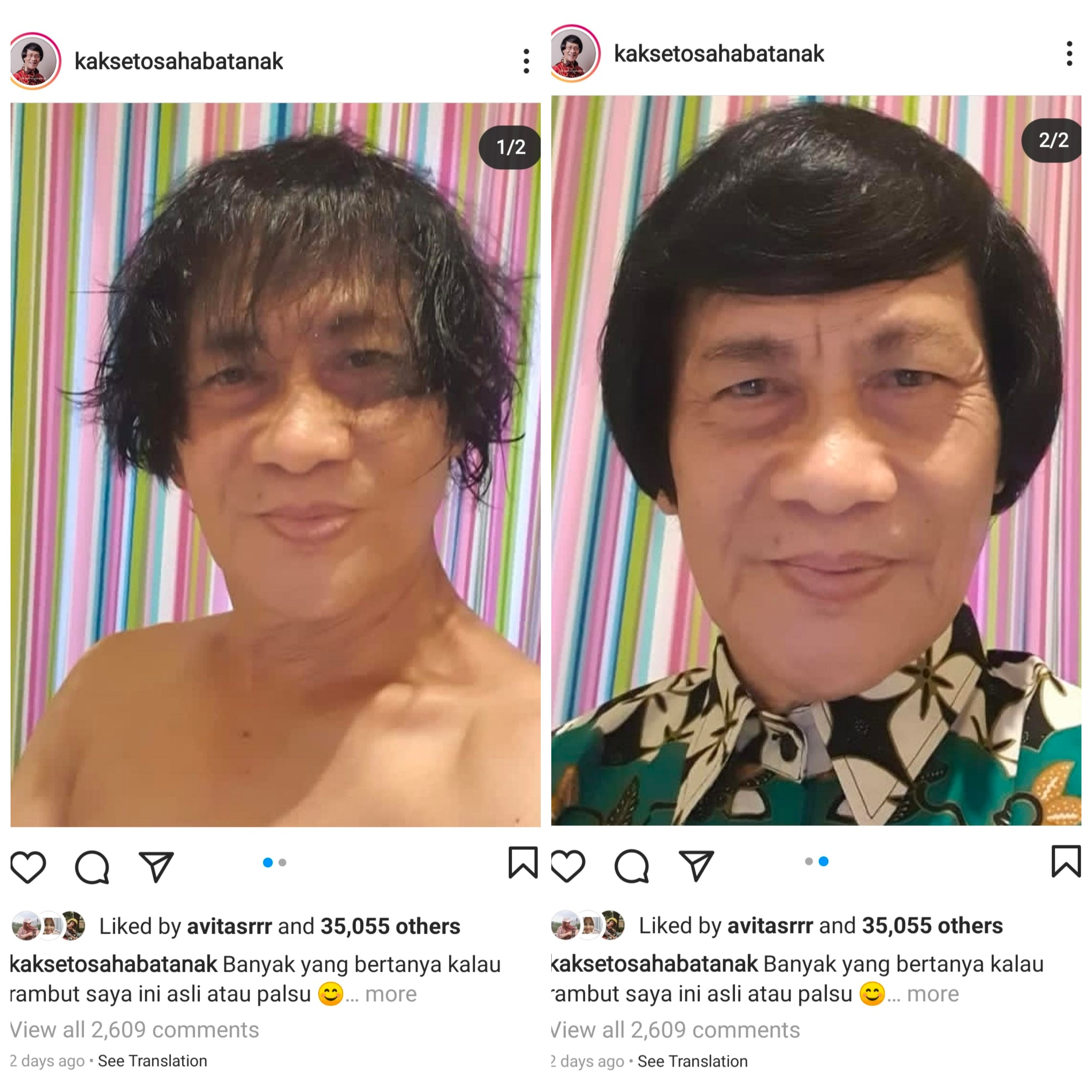 Misteri Keaslian Rambut Kak Seto Terkuak, Netizen: Akhirnya Bisa Tidur Nyenyak